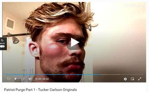 Image of Taylor used in Tucker's documentary to illustrate his assault in Utah